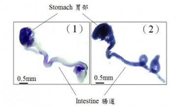 香港大學(xué)李嘉誠醫(yī)學(xué)院發(fā)現(xiàn)影響腸神經(jīng)細(xì)胞發(fā)育的新基因變異